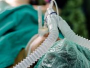 На Украине скончались почти 90% пациентов, подключенных к ИВЛ из-за COVID, общая летальность достигла 2,8%