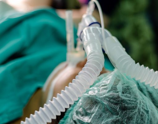 На Украине скончались почти 90% пациентов, подключенных к ИВЛ из-за COVID, общая летальность достигла 2,8%